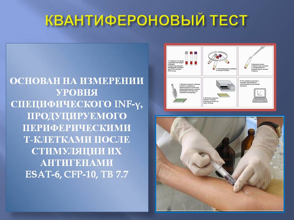 Купить справку квантифероновый тест в Москве Купить справку квантифероновый тест